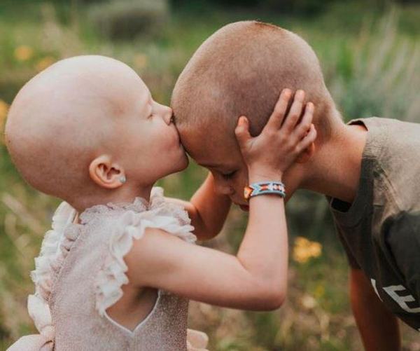 Dragoste de frate: S-a ras in cap pentru ca sora lui sa nu se simta singura in lupta cu cancerul