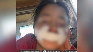 Doi frati din Arad au obtinut ordin de protectie impotriva parintilor. Tatal si-a batut fiica cu bestialitate, apoi a cusut-o el acasa cu ata