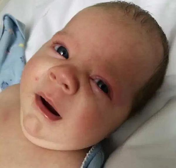 Mama unui bebelus trage un SEMNAL de ALARMA: "Stranuta des si avea un ochi rosu si umflat"