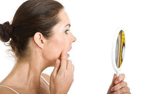 7 mituri despre acnee