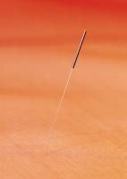 Acupunctura scade sansele fertilizarii in vitro