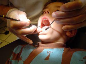 Creierului copiilor nu este afectat de plombele dentare