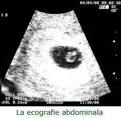 Polul fetal la prima ecografie