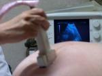 Testarea hipotiroidiei la gravide