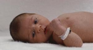 Copiii prematuri, adesea infectati cu micoplasme genitale