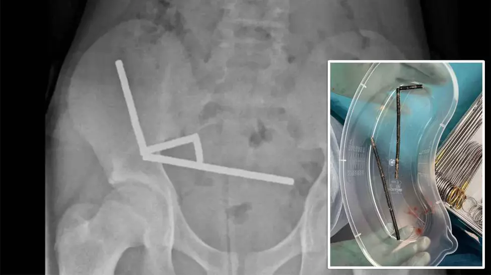 Baiat de 13 ani, operat de...