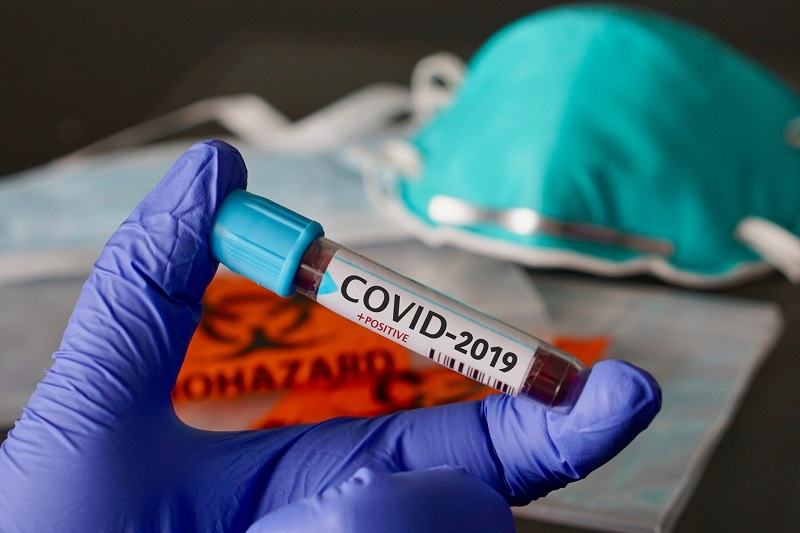 Secretar de stat: "In cel mai rau scenariu, vom ajunge la 10.000 de imbolnaviri cu COVID intr-un ritm rapid"
