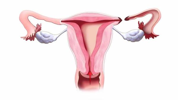 Inflamarea trompei uterine