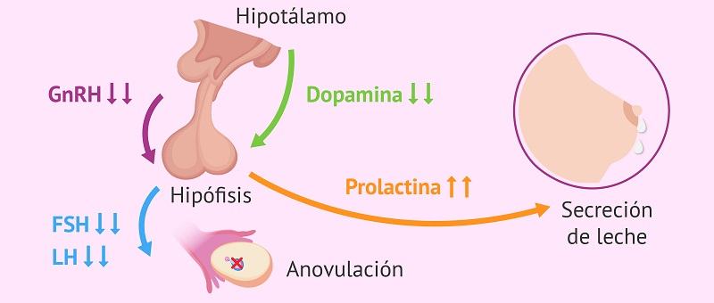 Hipersecretia de prolactina (hiperprolactinemia)