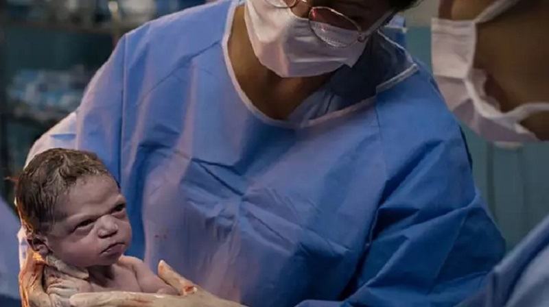 Fotografie virala: un nou-nascut se incrunta la medicul care l-a adus pe lume