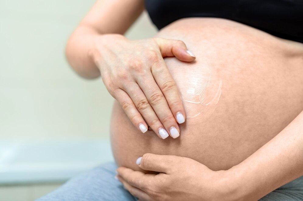 Vergeturile in timpul sarcinii. De ce apar si cum pot fi prevenite?
