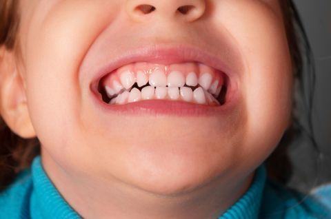 Probleme frecvente ale dintilor la copii