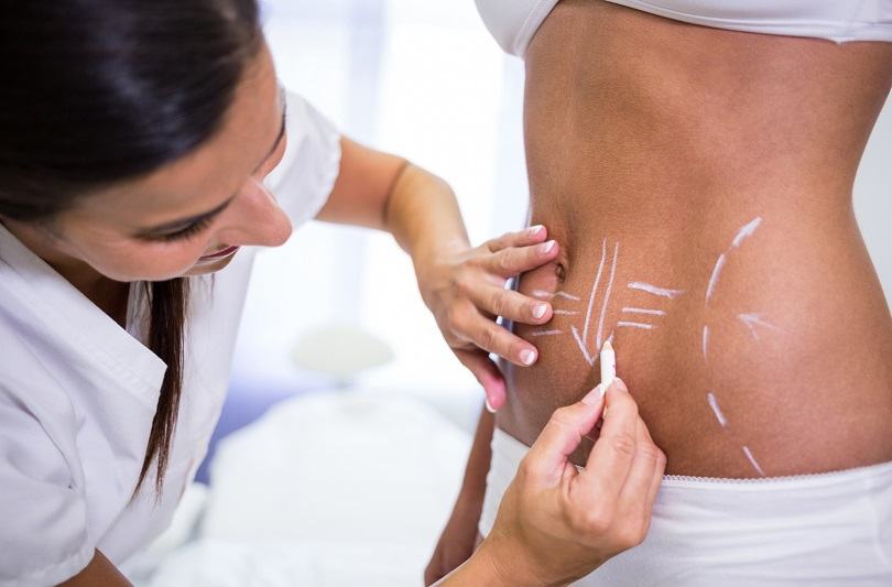 Remodelarea abdomenului dupa nastere: corset, lenjerie modelatoare si solutii eficiente recomandate de specialisti