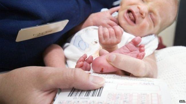 Ce boli se pot descoperi prin testul de calcai facut nou-nascutilor