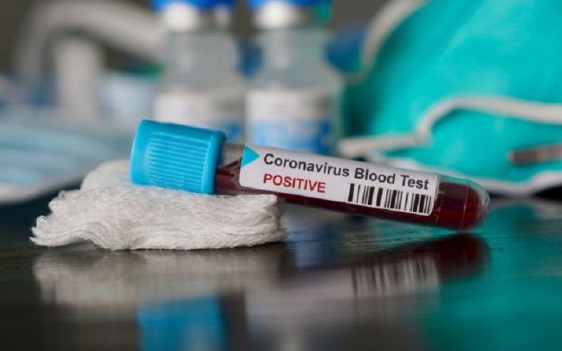 In Italia au fost confirmati primii copii infectati cu coronavirus