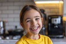 Caderea dintilor de lapte:...