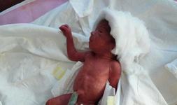 Un bebelus de doar 500 de grame s-a nascut la Spitalul Harsova. Medicii sunt optimisti