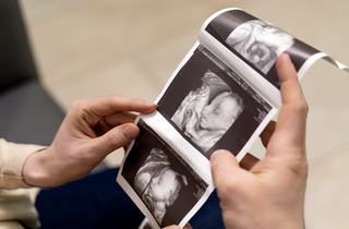 Morfologia de trimestrul 3: cand se face, ce verifica medicul si ce trebuie sa stie viitoarea mama