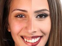 Estetica dentara in timp real,  inovatie stomatologica la Neoclinique