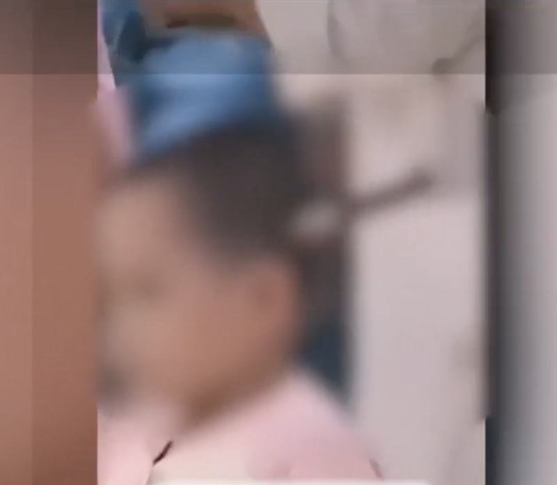 Imagine socanta la Urgente: Fetita de 3 ani a ajuns la spital cu un cutit infipt in cap