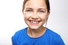 Gratuitate de la Primaria Capitalei: aparate dentare pentru copii