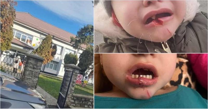 Incident socant intr-o gradinita din Ramnicu Valcea. Un parinte acuza ranirea grava a fiicei sale