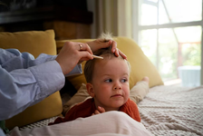 Alopecia la bebelusi: cauze si tratament