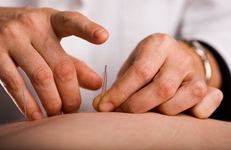 Acupunctura in sarcina. Beneficii