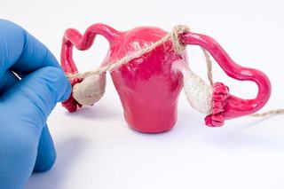 Contraceptia prin legarea trompelor uterine. Ce inseamna, avantaje si dezavantaje