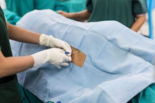 varicoza i anestezie epidurala
