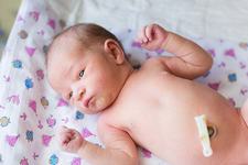 Hernia la bebelusi – simptome, factori de risc si tratament