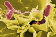 Cum se manifesta infectia cu Salmonella la copii. Multe alimente pot fi infestate