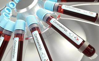 Record dramatic: 1.112 cazuri noi de persoane infectate cu SARS-CoV -2