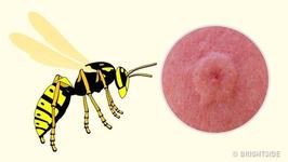 7 tipuri de intepaturi de insecte si cum sa le deosebesti