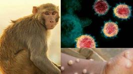 Primul copil infectat cu variola maimutei. Un baiat in varsta de 10 ani