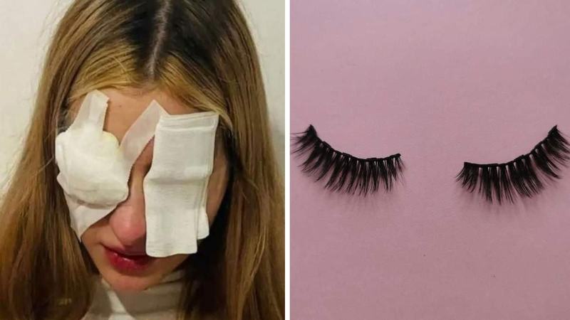 Avertismentul unei mame dupa ce fiica ei a ramas cu vederea in ceata din cauza genelor false. „Am dus-o in urgente”