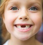Accidente la dintisori la copii