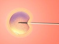 Inseminarea artificiala intravaginala
