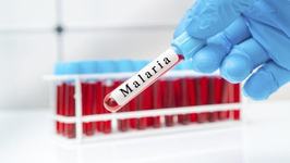 Cum s-au imbolnavit de...