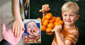 O poveste incredibila, dar reala: “Fiul meu a devenit portocaliu dupa ce a mancat prea multe portocale”