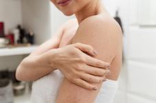 Psoriazisul, o afectiune...
