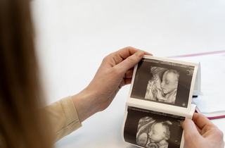 Calendarul ecografiilor in sarcina: ce se vede la fiecare etapa si cand afli sexul bebelusului