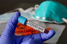 Secretar de stat: "In cel mai rau scenariu, vom ajunge la 10.000 de imbolnaviri cu COVID intr-un ritm rapid"